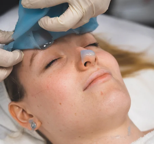 Facial procedure on face