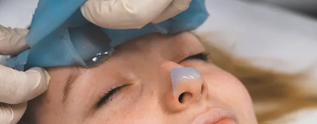 Facial procedure