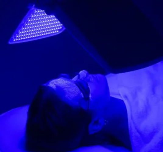 LED blue light therapy